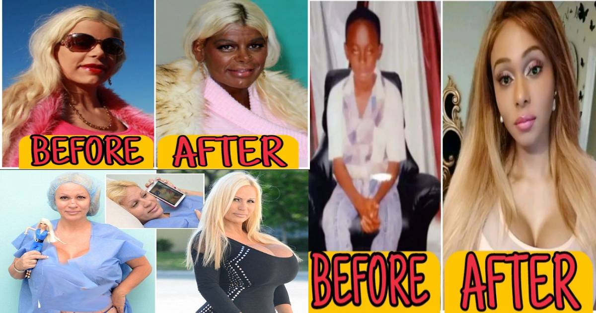 4 Celebrities Who Have Undergone Cosmetic Surgeries To Look Like Other People (Photos)