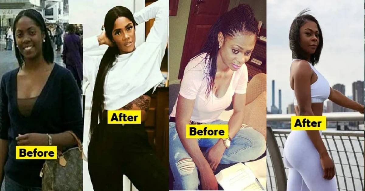 Checkout Alleged Photos Of Nigerian Celebrities Before And After Plastic Surgeries